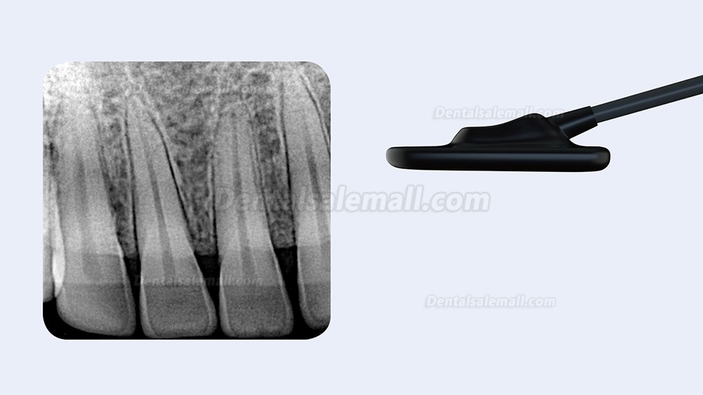Refine VeRay Portable Dental X-Ray Unit + Dental X-ray Intraoral Sensor Kit